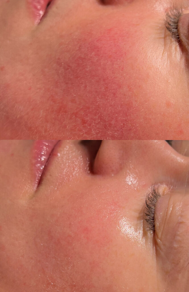 C0BEA5D4-5070-4F20-9C8F-913140783750