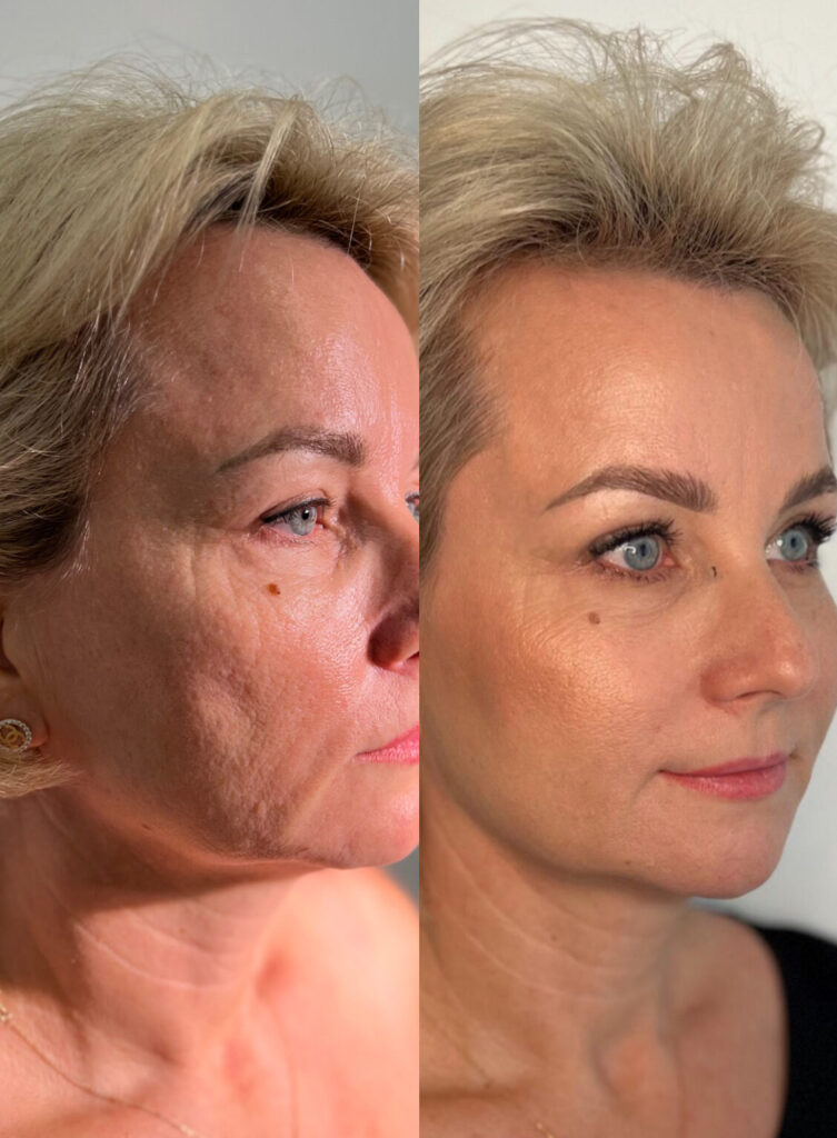 1E69DEA7-AC09-4591-BCA1-34E1364F5218